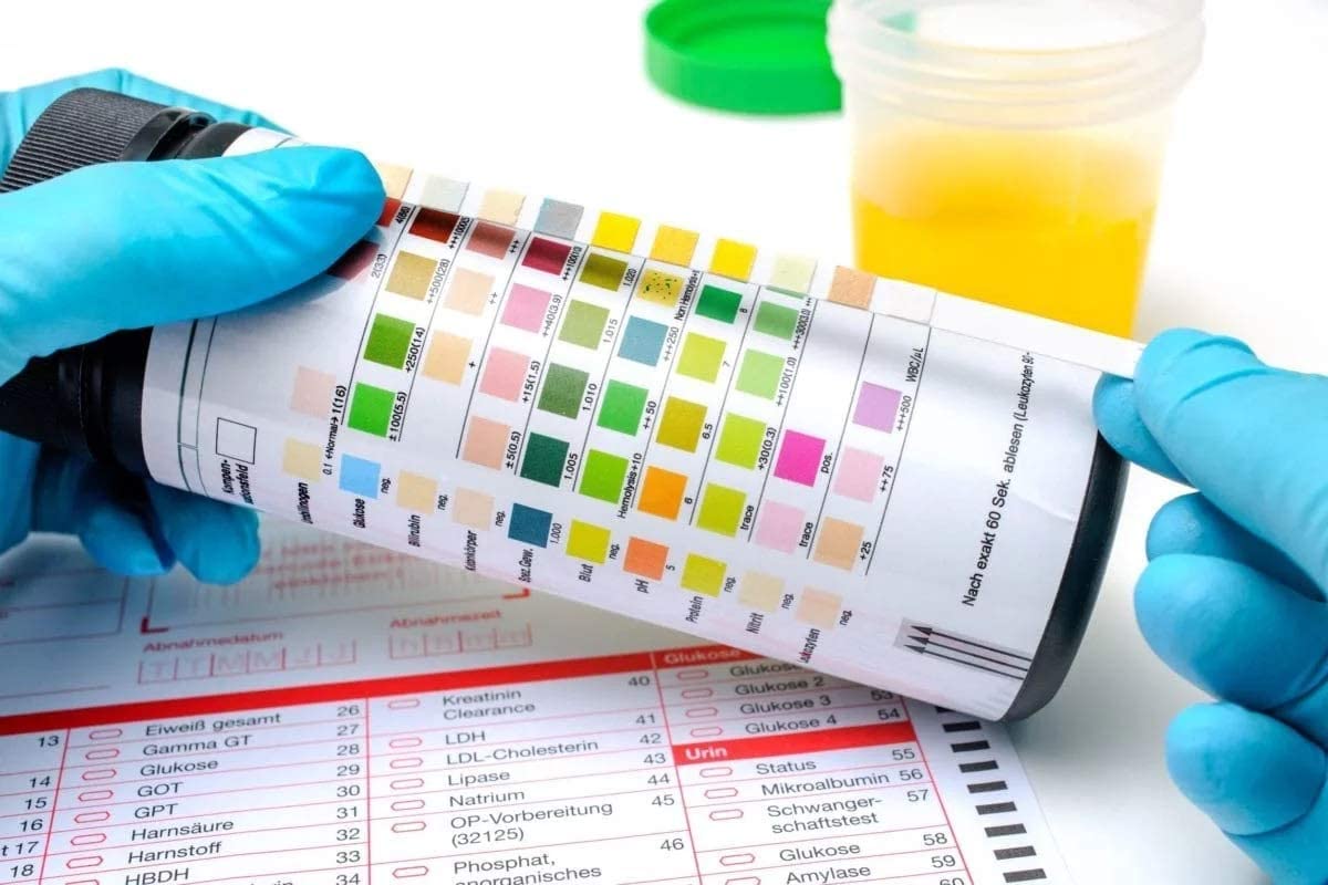 Médicaments qui colorent les selles et les urines